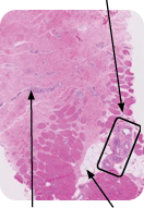 Histologia BTM: 12 meses