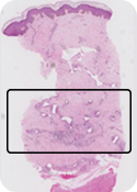 Histologia BTM: 7 meses