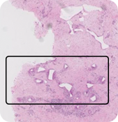 Histologia BTM: 7 meses