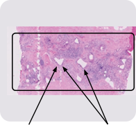 Histologia BTM: 8 meses